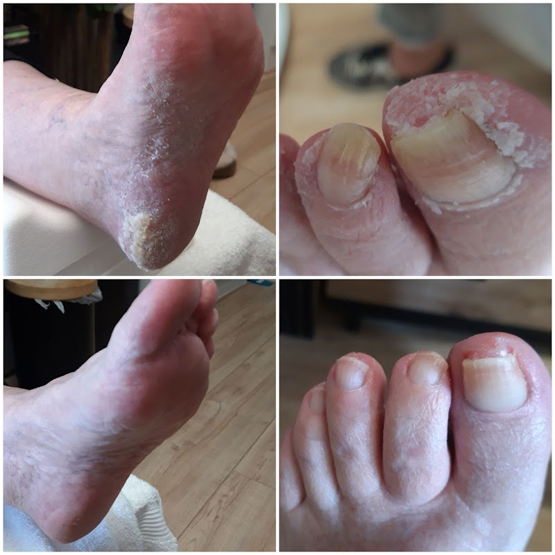 Anna's pedicure&nagelsalon - Hoofdfoto